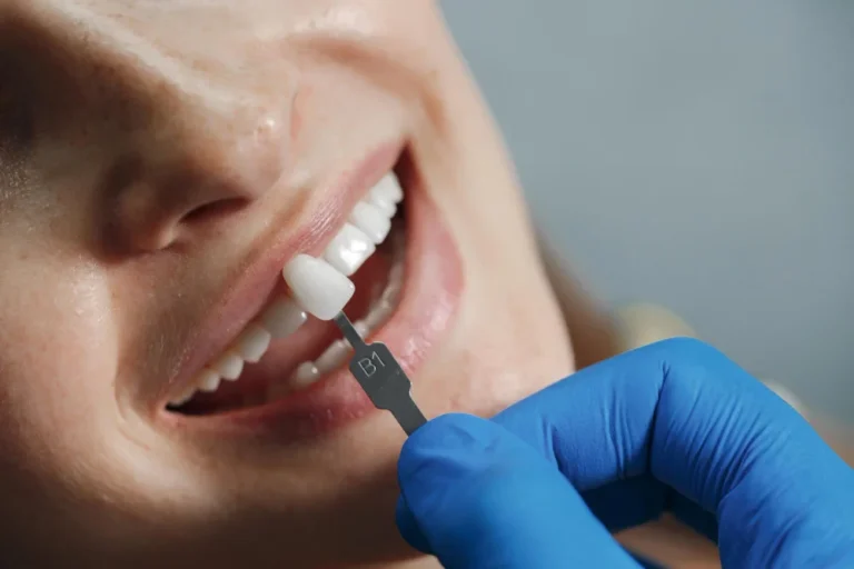 How 3D Imaging Is Revolutionizing Dental Implants